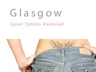 Glasgow Tattoo Removal - Tattoo Removal Company in Glasgow ...