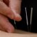 massage therapists in CHELTENHAM - Cheltenham Acupuncture