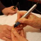 Allergy Testing by Jill Simmons