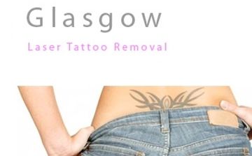Glasgow Tattoo Removal - Tattoo Removal Company in Glasgow 