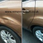 Remove-a-Dent
