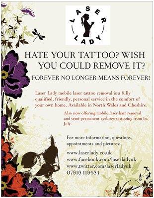 laser lady tattoo removal company in mold uk laser lady tattoo removal company in mold uk