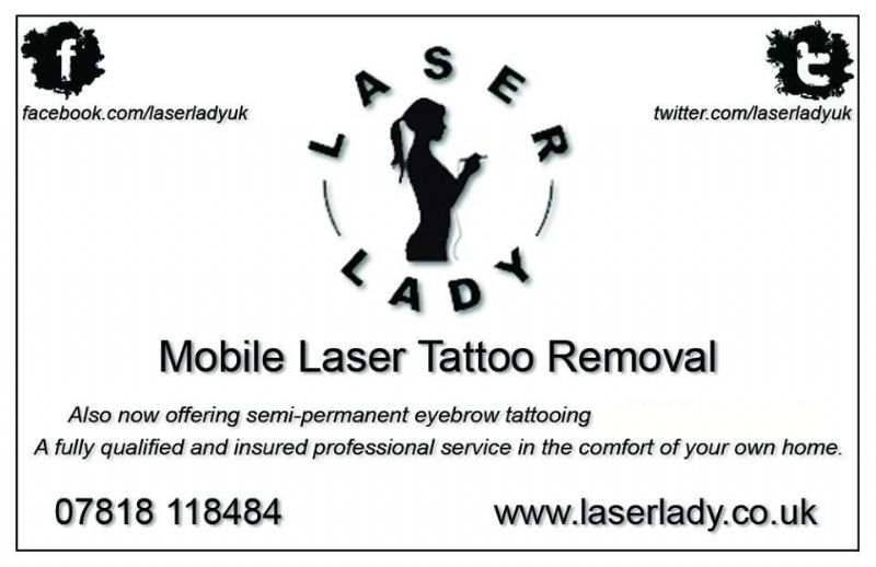 laser lady tattoo removal company in mold uk laser lady tattoo removal company in mold uk