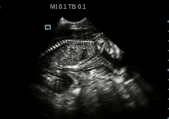 HomeScan Animal Ultrasound Pregnancy Scanning & Litter Microchipping