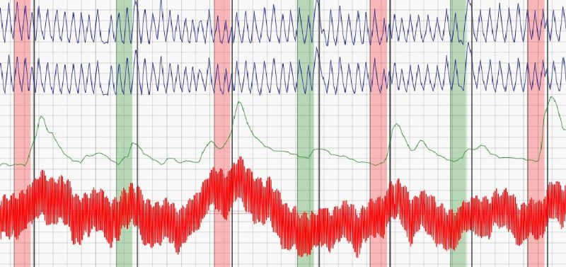 acura polygraphs ltd polygraph examination company in barnoldswick polygraph charts