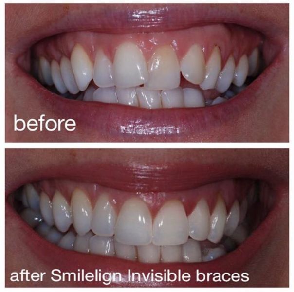 Smilelign Limited, Sheffield Dental Laboratory FreeIndex