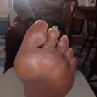 Ian Bruce Foot Health Professional MCFHP MAFHP
